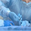 How to Approach Surgical Site Infection Wound Treatment With Specialist-Approved Methods