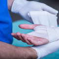 The Importance of Wound Care Specialists