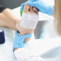 The Power of Wound Care Clinics: An Expert's Perspective