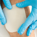 The Comprehensive Approach to Wound Care Management