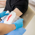 The Importance of Wound Care Centers: Goals and Treatment Options