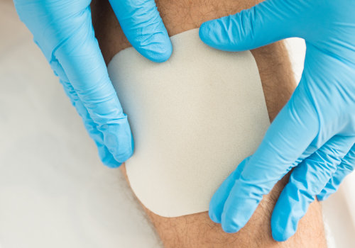 The Comprehensive Approach to Wound Care Management