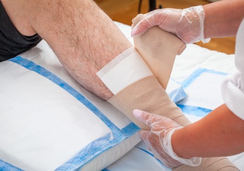 Specialist Guide To Managing Macerated Skin Wounds