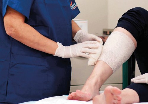 How Wound Care Experts Select The Best Dressing For Stage 2 Pressure Ulcers