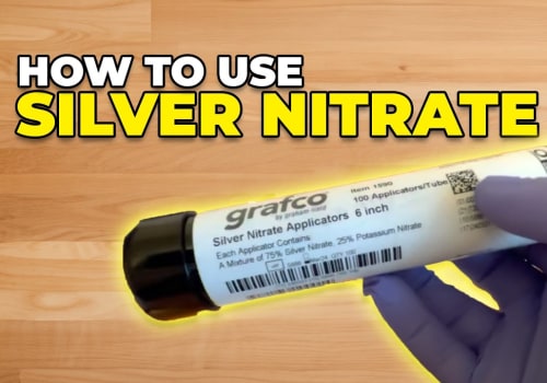 Are You Using Silver Nitrate Sticks on Skin the Right Way?