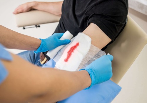 The Importance of Wound Care Centers: Goals and Treatment Options